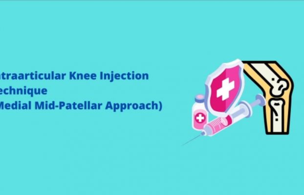 Intraarticular Knee Injection Technique (Medial Mid-Patellar Approach)