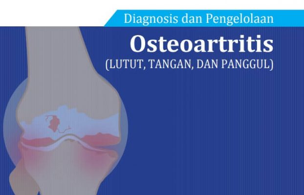 Rekomendasi OSTEOARTRITIS