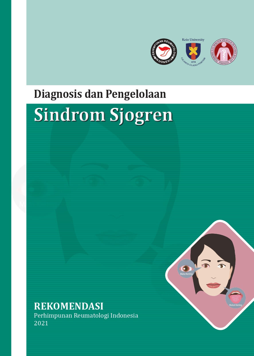 Rekomendasi Sindrom Sjogren