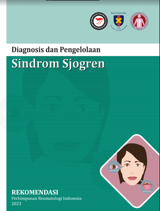 Rekomendasi Sindrom Sjogren
